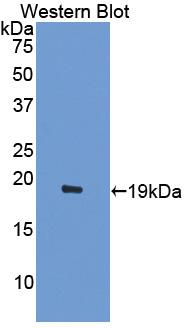 Polyclonal Antibody to Activin A Receptor Type II A (ACVR2A)