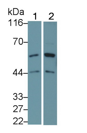 Polyclonal Antibody to Activin A Receptor Type II B (ACVR2B)