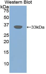 Polyclonal Antibody to Transforming Growth Factor Beta Receptor III (TGFbR3)