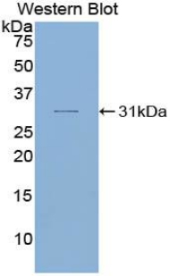 Polyclonal Antibody to SMAD family member 6 (SMAD6)