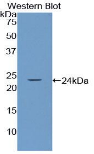 Polyclonal Antibody to SMAD family member 3 (SMAD3)