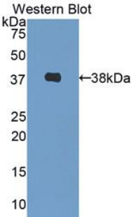 Polyclonal Antibody to Decorin (DCN)