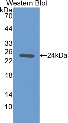 Polyclonal Antibody to Noggin (NOG)