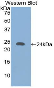 Polyclonal Antibody to Collagen Type XVIII (COL18)