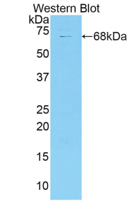 Polyclonal Antibody to Collagen Type XVIII (COL18)