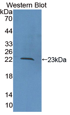 Polyclonal Antibody to Collagen Type XVI (COL16)