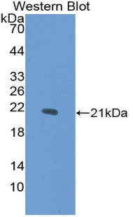 Polyclonal Antibody to Collagen Type XV (COL15)