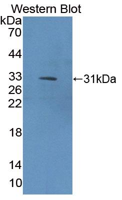 Polyclonal Antibody to Collagen Type IX Alpha 1 (COL9a1)