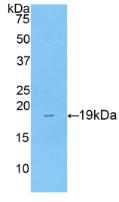 Polyclonal Antibody to Collagen Type VIII Alpha 1 (COL8a1)