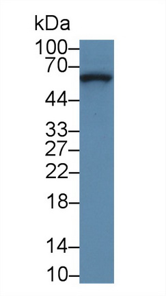 Polyclonal Antibody to Collagen Type VIII Alpha 1 (COL8a1)