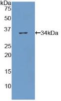 Polyclonal Antibody to Collagen Type VII (COL7)