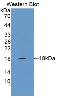 Polyclonal Antibody to Collagen Type X (COL10)