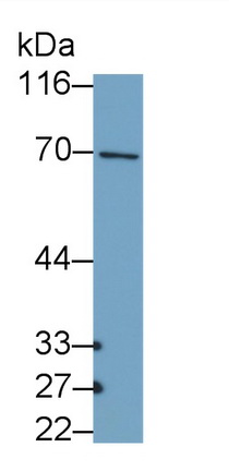 PAC156Hu01.jpg