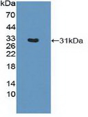 Polyclonal Antibody to HLA Class II Histocompatibility Antigen, DRB1 Beta Chain (HLA-DRB1)