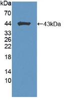 Polyclonal Antibody to Brevican (BCAN)