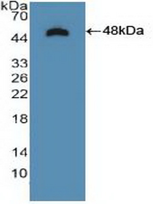 Polyclonal Antibody to Tropomyosin Receptor Kinase B (TrkB)