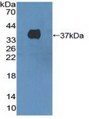 Polyclonal Antibody to C-Met (MET)