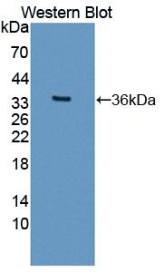 Polyclonal Antibody to Methyl CpG Binding Domain Protein 2 (MBD2)
