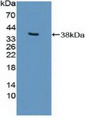 Polyclonal Antibody to E1A Binding Protein P300 (EP300)