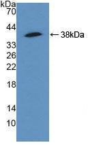 Polyclonal Antibody to Actinin Alpha 4 (ACTN4)