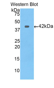 Polyclonal Antibody to Profilin 1 (PFN1)