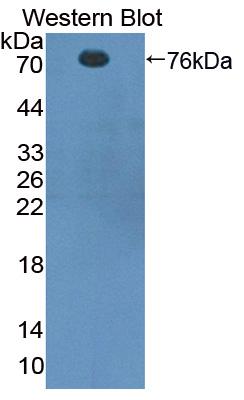 Polyclonal Antibody to Cortactin (CTTN)