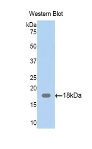 Polyclonal Antibody to Zyxin (ZYX)