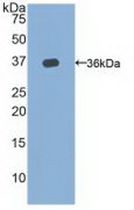 Polyclonal Antibody to Telomerase Reverse Transcriptase (TERT)