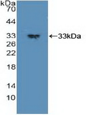 Polyclonal Antibody to Phosphoinositide Dependent Protein Kinase 1 (PDPK1)