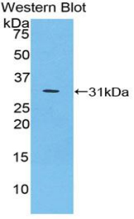 Polyclonal Antibody to Inhibitory Subunit Of NF Kappa B Zeta (IkBz)