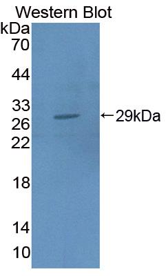 Polyclonal Antibody to Fusion (FUS)