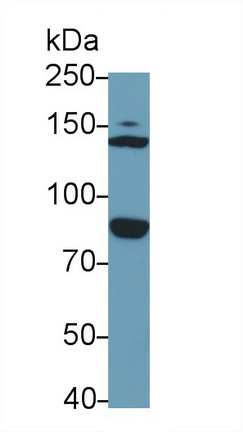 Polyclonal Antibody to Erythrocyte Membrane Protein Band 4.1 (EPB41)