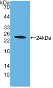 Polyclonal Antibody to Disrupted In Schizophrenia 1 (DISC1)