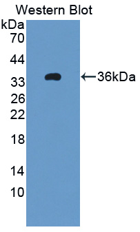 Polyclonal Antibody to 11-Beta-Hydroxysteroid Dehydrogenase Type 1 (HSD11b1)