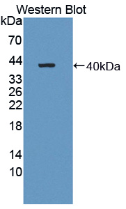 Polyclonal Antibody to Aminoadipate Semialdehyde Phosphopantetheinyl Transferase (AASDHPPT)