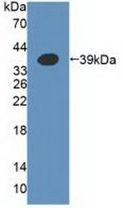 Polyclonal Antibody to Alpha-1,4-Galactosyltransferase (a4GALT)