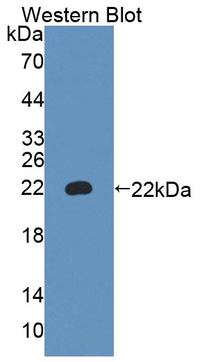 Polyclonal Antibody to Alpha-1,4-Galactosyltransferase (a4GALT)