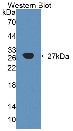 Polyclonal Antibody to Alpha-1,4-Galactosyltransferase (a4GALT)