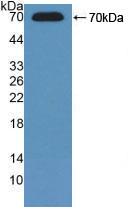 Polyclonal Antibody to Adenosine Kinase (ADK)