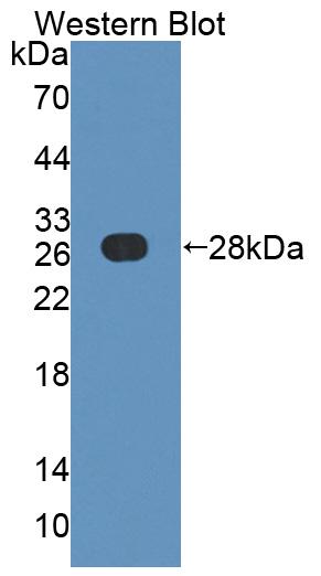 Polyclonal Antibody to Actin Filament Associated Protein 1 (AFAP1)