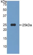 Polyclonal Antibody to Afamin (AFM)