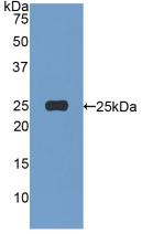 Polyclonal Antibody to Afamin (AFM)