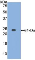 Polyclonal Antibody to Afamin (AFM)