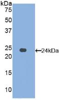 Polyclonal Antibody to Afamin (AFM)