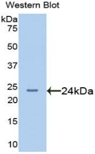 Polyclonal Antibody to Afamin (AFM)