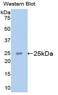 Polyclonal Antibody to Apolipoprotein M (APOM)