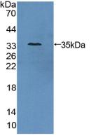 Polyclonal Antibody to Antizyme Inhibitor 1 (AZIN1)