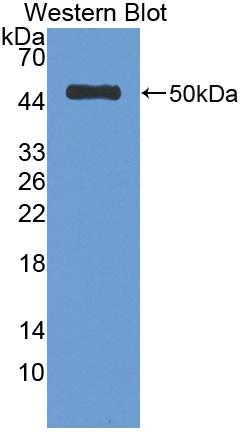 Polyclonal Antibody to Antithrombin (AT)