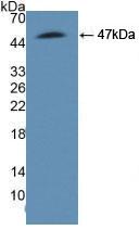 Polyclonal Antibody to Argininosuccinate Synthetase 1 (ASS1)