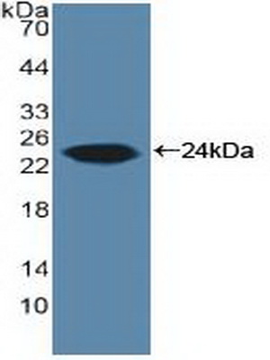 Polyclonal Antibody to Aromatase (ARO)